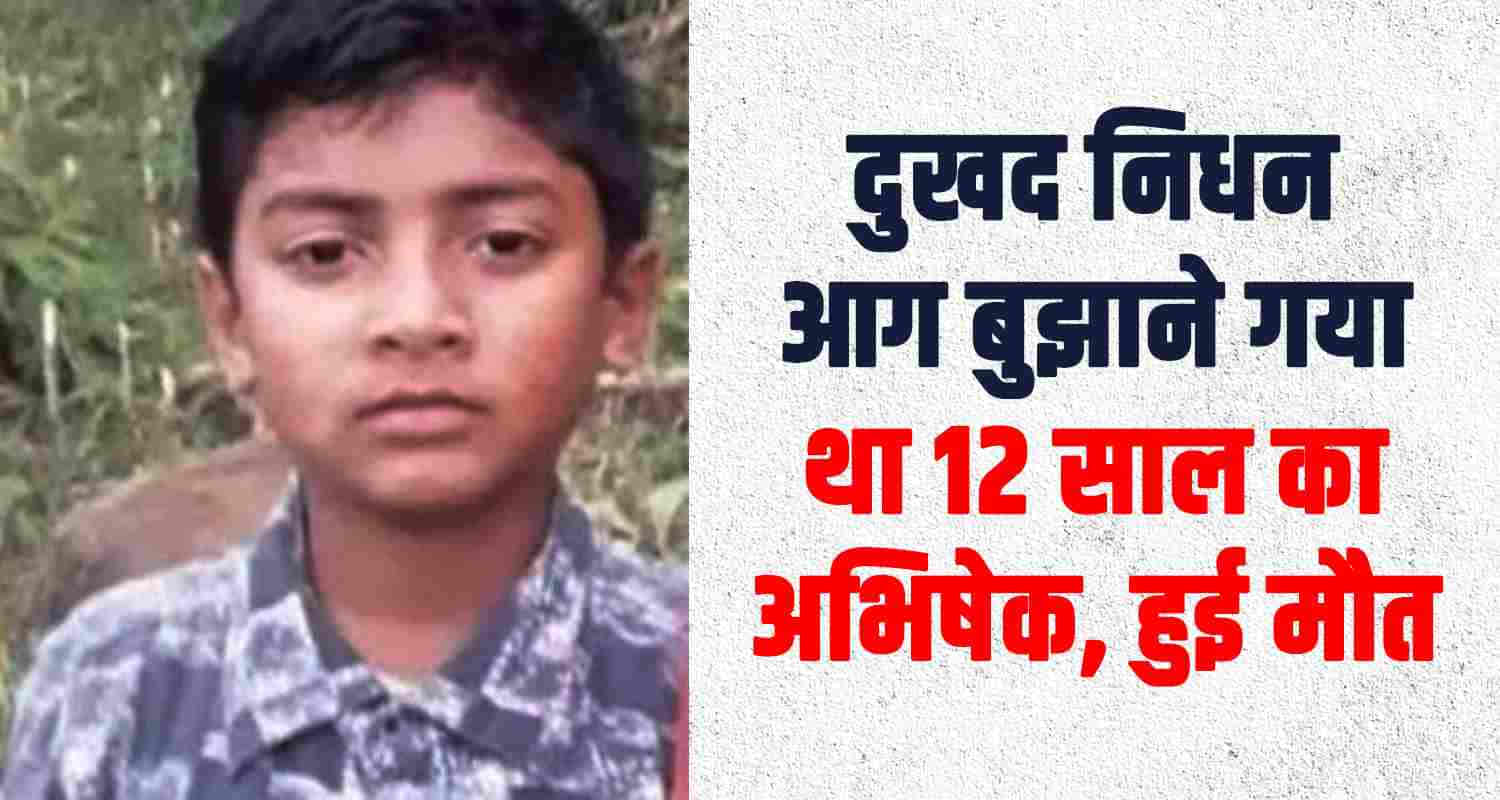 Himachal nahan paonta sahib burnt 12 year old boy