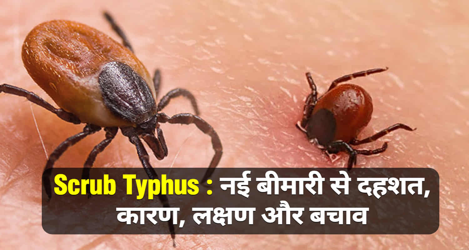 Scrub typhus symptoms treatment disease cure himachal pradesh