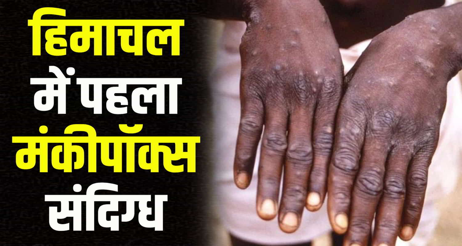 Himachal first monkey pox patient found in hamirpur returned from canada and america
