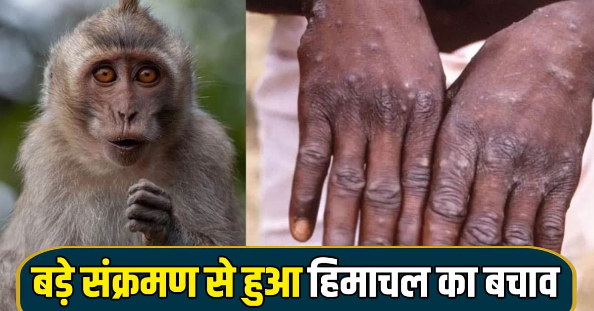 Relief news himachal monkey pox suspect turns negative