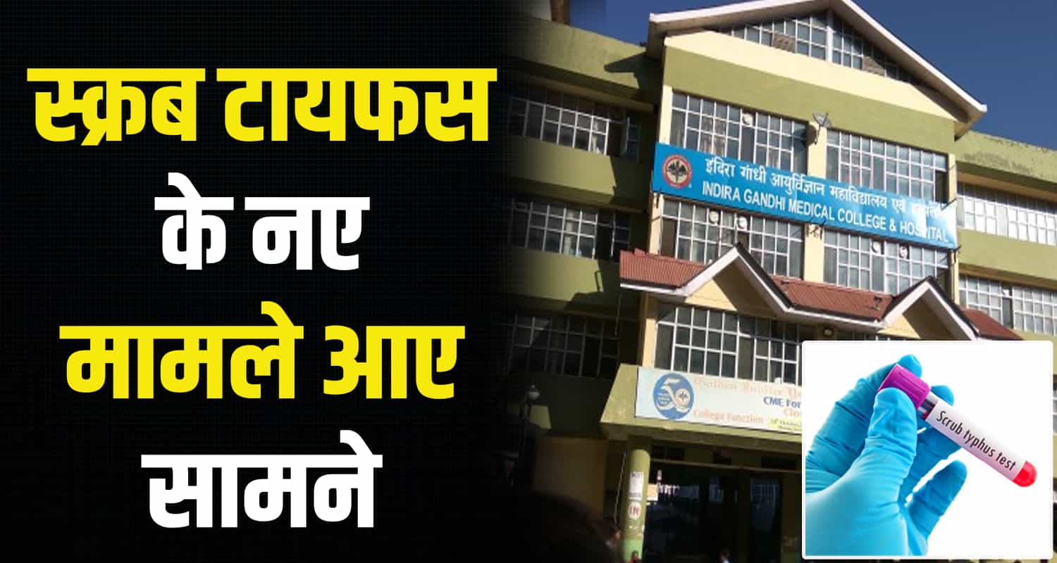 Scrub typhus igmc shimla 4 new patients himachal pradesh
