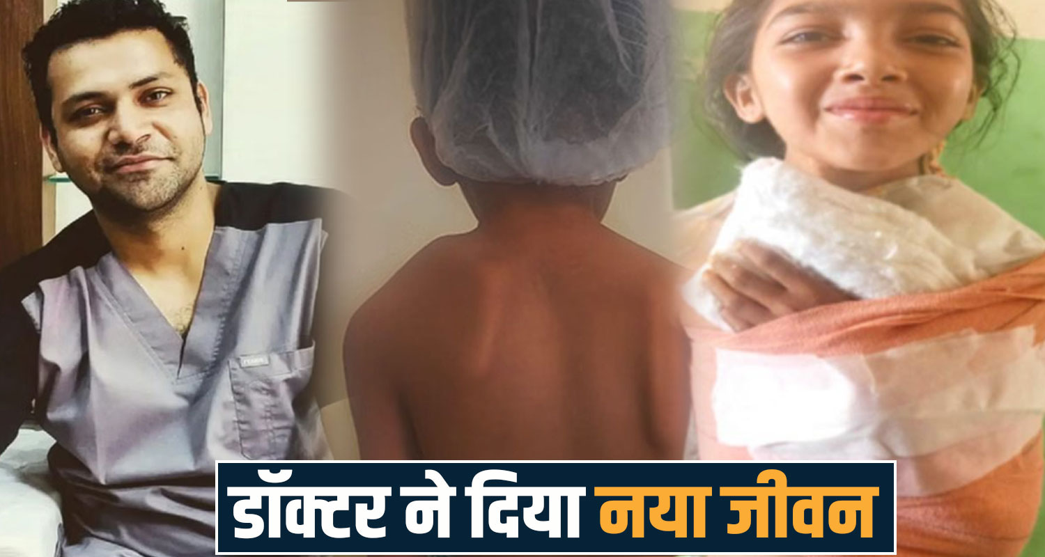 successful surgery congenital sprengel shoulder