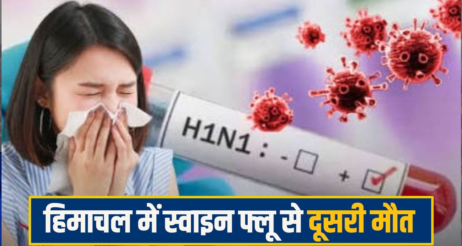 IGMC swine Flu 